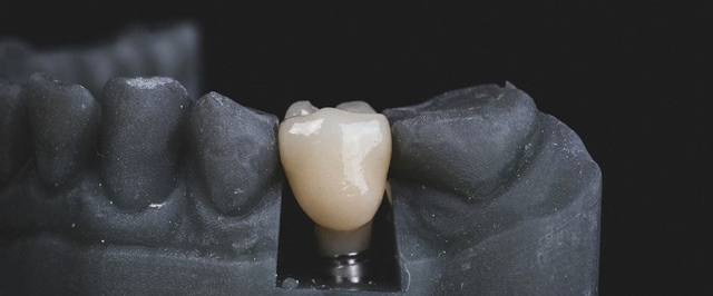 Древний зуб доказал: скарлатина появилась в Америке задолго до европейцев